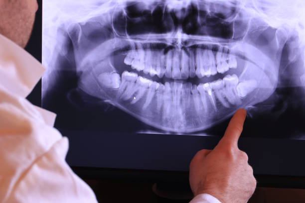 Best Emergency Dental Filling Replacement  in Reynolds Heights, PA